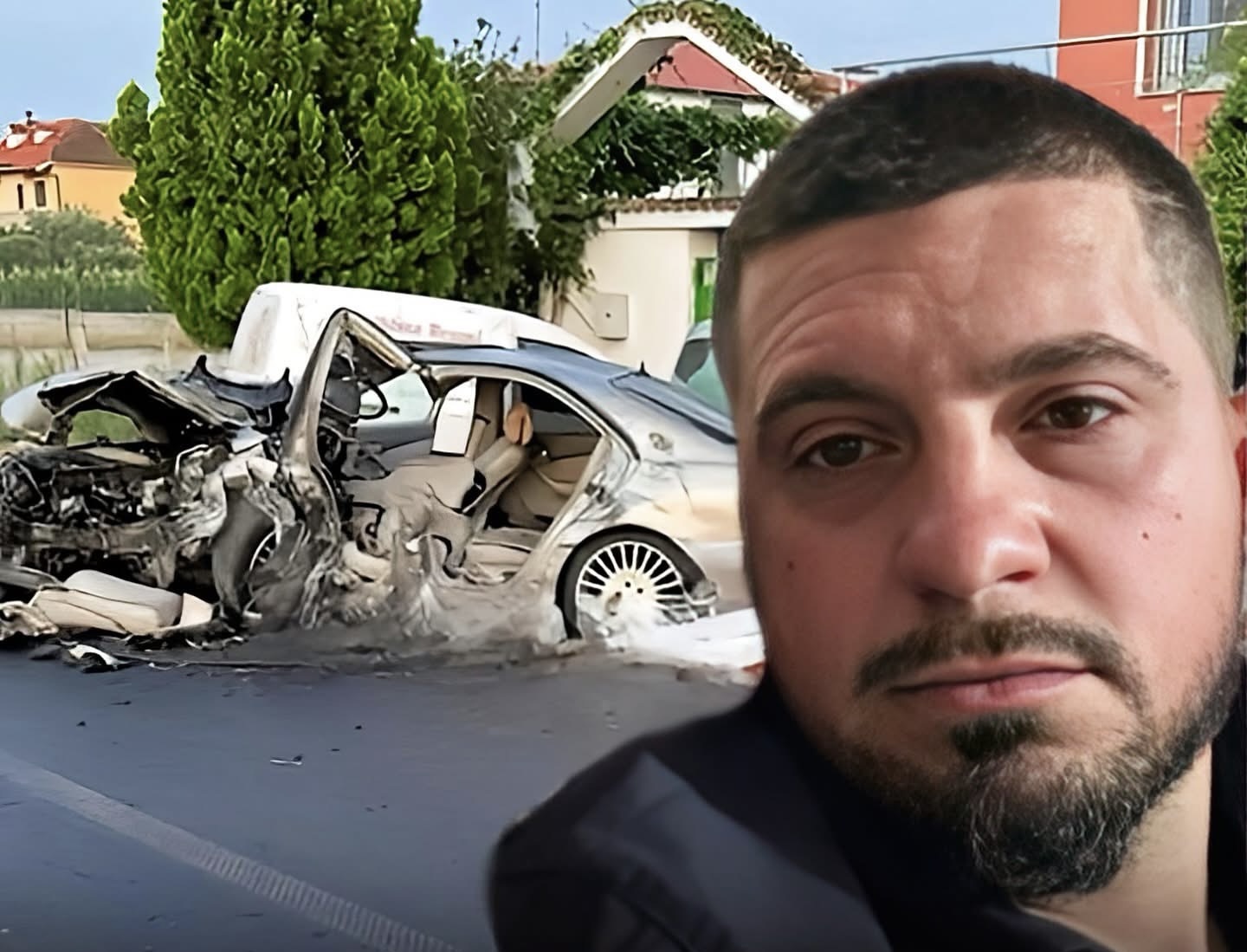 4 muaj betejë, humb jetën djali i ri i aksidentuar disa ditë më parë  img 6630